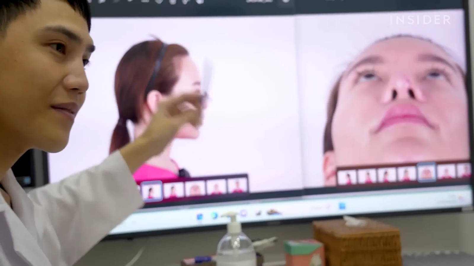 מלי מתכננת ניתוח אף