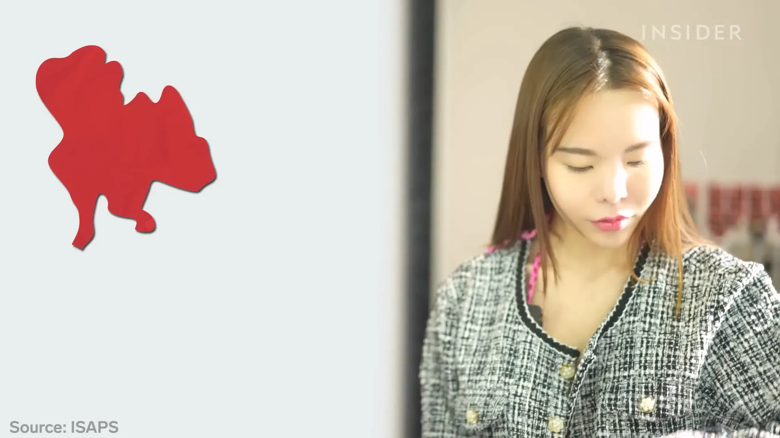 גרף הצמיחה של ניתוחים קוסמטיים