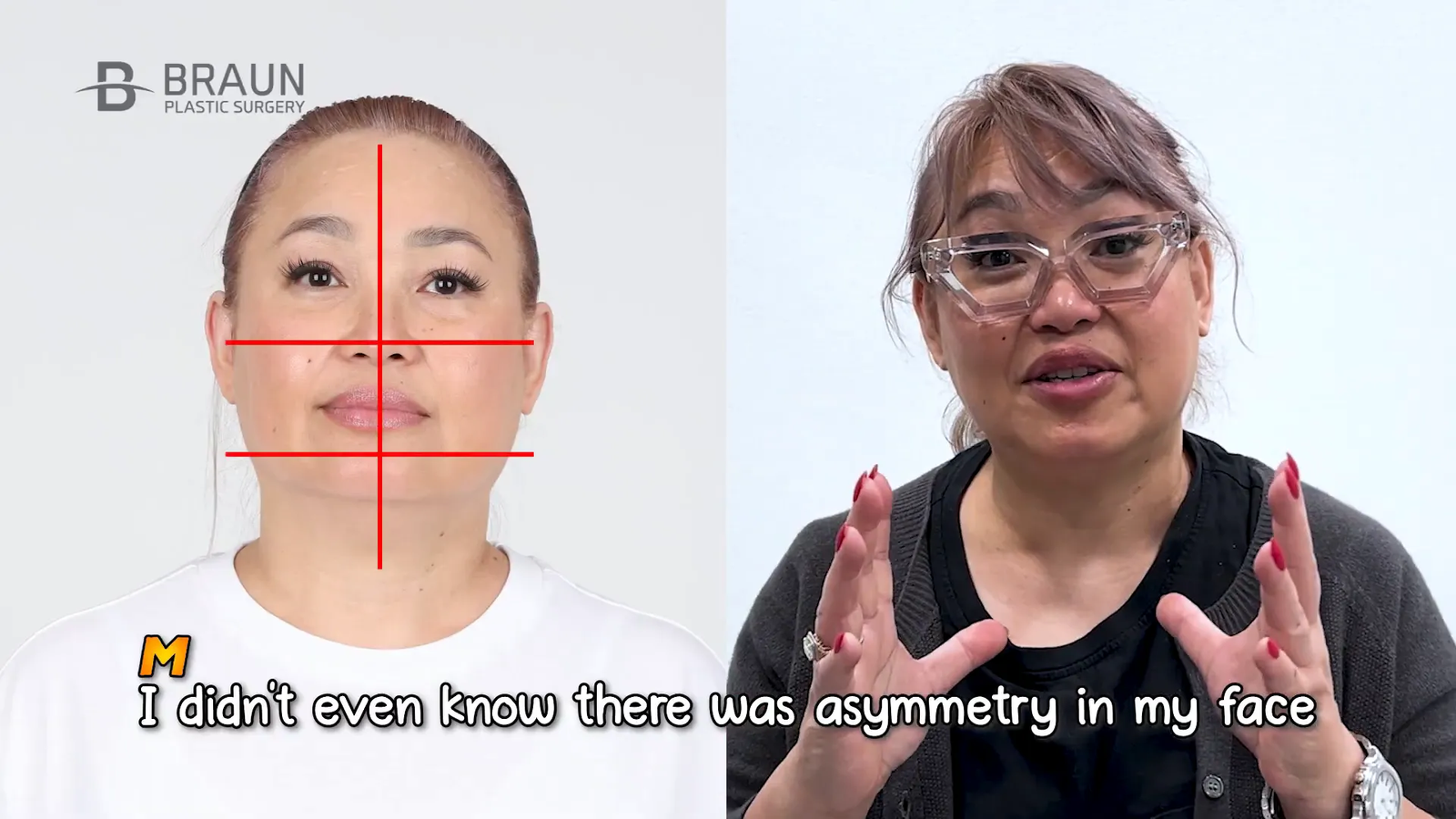 הבנת הסימטריה בפנים