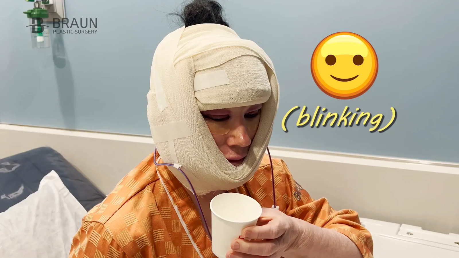 סרינה לאחר הניתוח עם תחבושות סביב העיניים