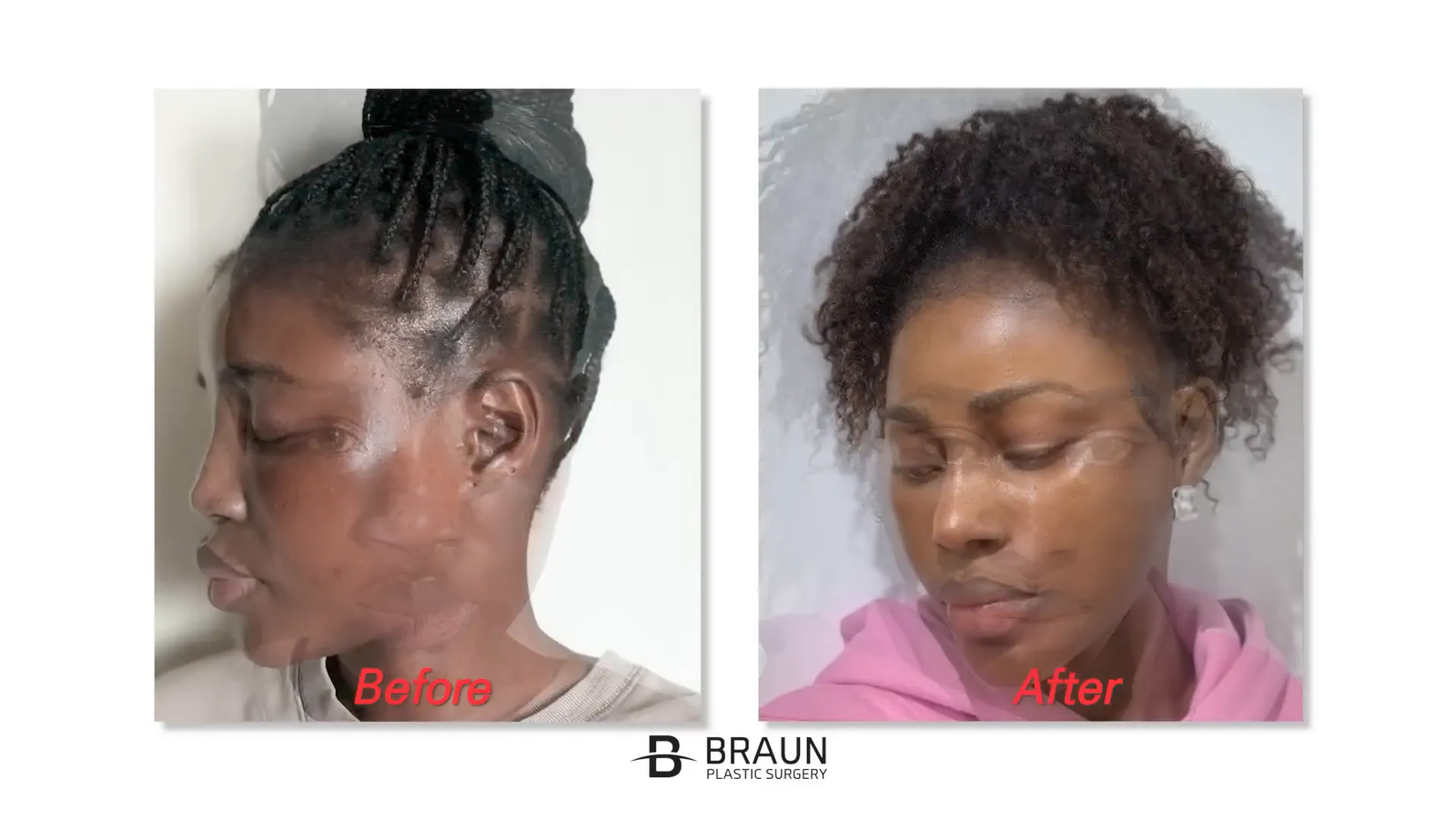 התחייבות לחזור עם התוצאות הסופיות